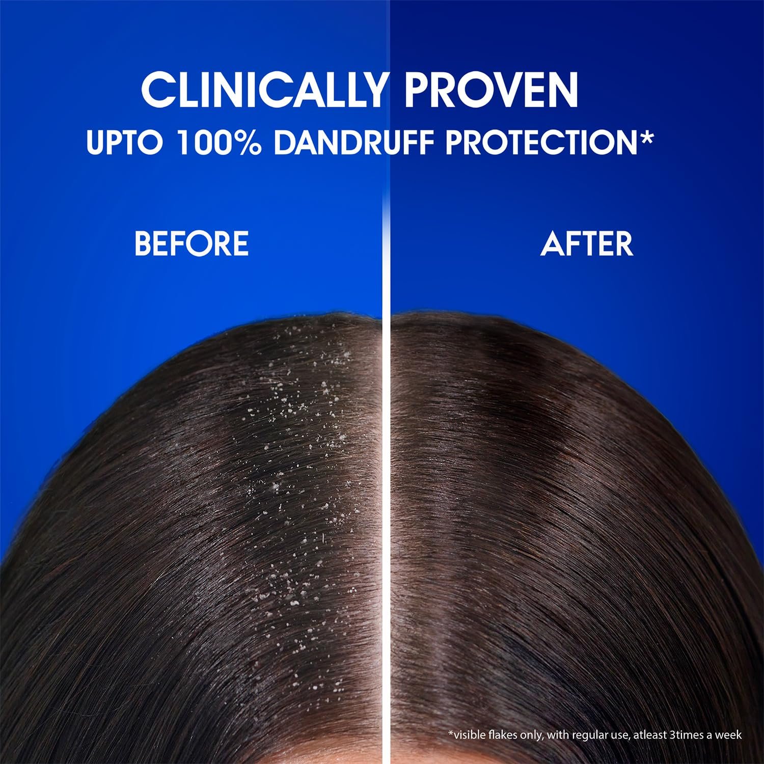 81TmxodmtWL._SL1500_ Head & Shoulders Smooth and Silky, Anti Dandruff Shampoo for Women & Men , 1 L - Image 3
